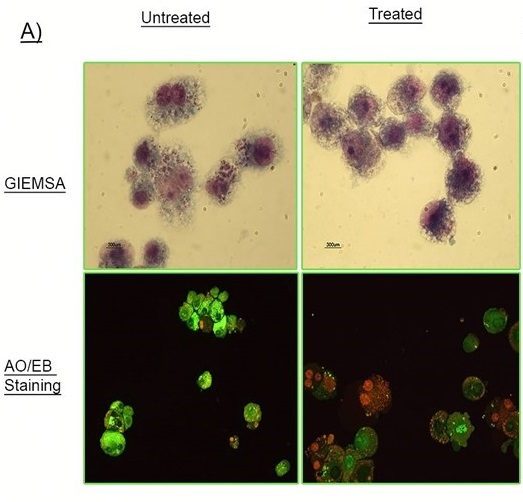 A Simple Technique for Simultaneously Quantifying Cell Death Index and Infection Index on in vitro Cell- Based Susceptibility Assays